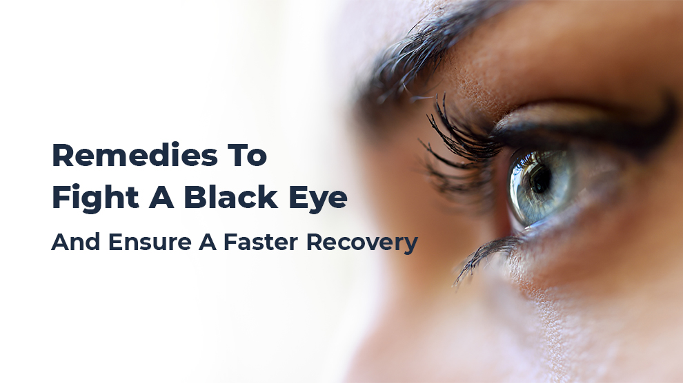 Remedies To Fight A Black Eye And Ensure A Faster Recovery